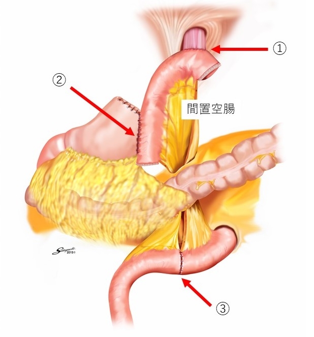stomach1.jpg